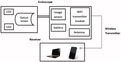Figure 1. Structural diagram of wireless Wi-Fi electronic endoscope.