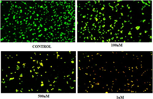 Figure 10. Morphology of untreated Ishikawa cells (control) and those treated with 0.1, 0.5, and 1 µM of compound 14.