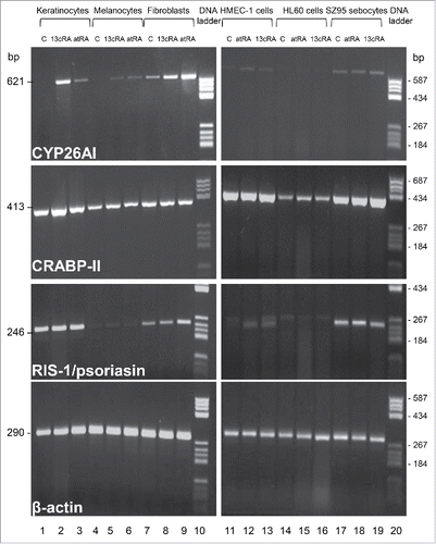 Figure 1. rtPCR detection of CYP26AI, CRABP-II and RIS-1/psoriasin mRNA expression. Lanes 1–3, primary human keratinocytes; lanes 4–6, primary human melanocytes; lanes 7–9, primary human fibroblasts, lane 10, DNA mass ladder; lanes 11–13, human immortalized vascular endothelial cell line HMEC-1; lanes 14–16, human promyelocytic leukemia cell line HL-60, lanes 17–19, human immortalized SZ95 sebocytes; lane 20, DNA mass ladder. DMSO control (C, lanes 1, 4, 7, 11, 14, 17), 13cis-retinoic acid in DMSO (13cRA, 10−7 M; lanes 2, 5, 8, 13, 16, 19), all-trans retinoic acid in DMSO (atRA, 10−7 M; lanes 3, 6, 9, 12, 15, 18).
