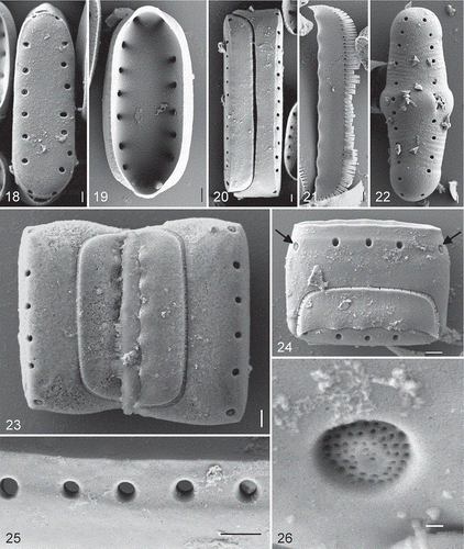 Figs. 18–26. Diprora haenaensis from Maniniholo Dry Cave, Kauaʻi, Hawaiʻi, USA, SEM. 18. External view of the valve face showing large areolae. 19. Internal view of valve. 20. Girdle view of the whole frustule showing overlap of the epi- and hypovalves. 21. Girdle band with fimbriate margin. 22. External view of an initial valve showing grooves imprinted from perizonial bands. 23, 24. Girdle view of two attached cells showing girdle band structure. 25. Detailed external view of marginal areolae showing them to lack occlusions. 26. High magnification external view of terminal areola showing recessed, hymenate occlusions. Scale bars = 1 µm (Figs 18–25) and 100 nm (Fig. 26).