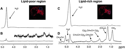 Figure 7. Demonstration of the magnetic resonance(MR) image‐guided, single‐voxel ex vivo1H magnetic resonance spectroscopy (MRS) to characterize lipid‐rich and lipid‐poor regions of atherosclerotic plaque. Spectra elicited from 1‐mm3 voxels are illustrated with insets showing the parametric map and voxel position for reference. Panels A and C illustrate the intense water signal without water suppression. Weak lipid signals are evident in panel B only after vertical expansion (inset). In contrast, strong lipid signals (consistent with cholesterol esters) are seen in panel D. (With permission from Ruberg et al. 2006 Citation73.)