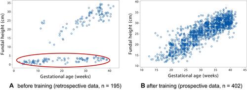 Figure 3 FH and GA data available for fetal weight estimation. [Source: Anggraini, et al. Citation38]. (A) before training (retrospective data, n = 195). (B) after training (prospective data, n = 402).