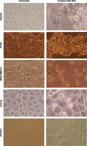 Figure 7 The morphological changes of HepG2 cells, HT29 cells, MDD-MB231 cells, Chang cells, and HUVECs treated with iron–manganese-promoted sulfated zirconia nanoparticles at their respective IC50 concentrations for 72 hours..Abbreviations: HUVEC, human umbilical vein endothelial cell; IC50, concentration of drug needed to inhibit cell growth by 50%; NPs, nanoparticles.