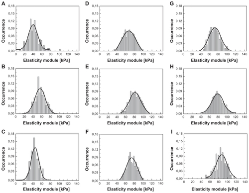 Figure 6 Histograms of red blood cell elasticity modules incubated with aminophylline for two hours, 0.01 mg/mL (A); six hours, 0.01 mg/mL (B); 12 hours, 0.01 mg/mL (C); two hours, 0.1 mg/mL (D); six hours, 0.1 mg/mL (E); 12 hours, 0.1 mg/mL (F); two hours, 1.0 mg/mL (G); six hours, 1.0 mg/mL (H); 12 hours, 1 mg/mL (I).