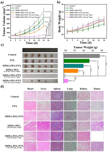 Figure 7 (A) Tumor volume curves of A549 tumor-bearing mice with different treatments (for laser, MPDA-PEG + 2 W cm−2 Laser and MPDA-PEG-PTX + 2 W cm−2 Laser groups, tumors are irradiated by 808 nm laser for 5 mins, for MPDA-PEG-PTX + 1 W cm−2 Laser group, tumors are irradiated by 808 nm laser for 10 mins). (B) Body weight curves of mice of each group. (C) Photos and weight of tumors dissected from each group on the 14th day after photothermal treatment. (D) H&E staining images of major organs (heart, liver, spleen, lung, and kidney) and tumor tissues dissected from each group on the 14th day after photothermal treatment (40 X). The scale bars are 100 μm. Data are means ± sd. N = 5. ***p < 0.001 and n.s. represents no significance.Abbreviations: MPDA-PEG-PTX, paclitaxel loaded polyethylene glycol-modified mesoporous polydopamine; H&E, hematoxylin-eosin staining.