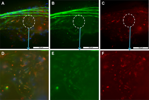 Figure S3 Representative macrophages in ApoE−/− atherosclerotic plaque express JNK2.Notes: Upper and lower rows are lower- and higher-power images from encircled regions, respectively. Representative fluorescence-microscopy images of JNK2 and macrophage costaining of aortas of ApoE−/− mice on high-fat diet. (A and D) Overlay images of JNK2 and macrophage costaining; (B and E) JNK2 staining; (C and F) macrophage staining. Magnification of D–F is 40×.