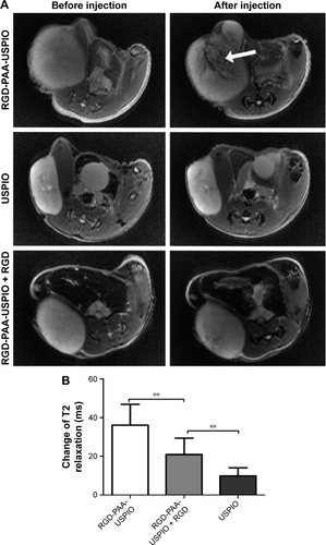 Figure 4 Evaluation of integrin αvβ3 binding in vivo.Notes: (A) T2-weighted MR imaging of tumor before and 6h after intravenous injection of RGD-PAA-USPIO, plain USPIO, or RGD-PAA-USPIO plus free RGD peptide. (B) The corresponding T2 relaxation time decrease of tumors before and after probe injection. **P<0.01. The arrow in Figure 4A refer to the signal intensity decrease caused by the injection of RGD-PAA-USPIO.Abbreviations: MR, magnetic resonance; PAA, polyacrylic acid; RGD, arginine-glycine-aspartic acid; USPIO, ultrasmall superparamagnetic iron oxide.