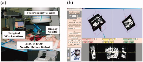 Figure 14. Three-dimensional ultrasound guided robot puncture needle placement system. (a) Experimental institution; (b) 3D ultrasonic interface.