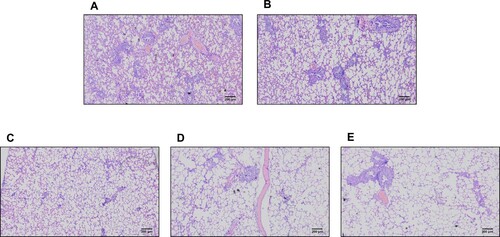 Figure 3. Histopathology of lungs following reinfection. Previously infected ferrets were inoculated with 105.0 TCID50 of CBNU-nCoV02 (GH clade) virus. Tissues were harvested on day 6 after inoculation. Group 1 (control group) (A), Group 2 (NAb titre < 20) (B), Group 3 (NAb 20–40) (C), Group 4 (NAb titre 80) (D), and Group 5 (NAb titre 160) (E). Magnification 40X.
