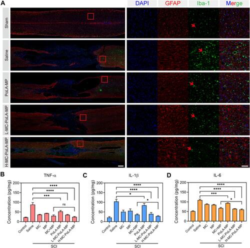 Figure 6 Treatment of TSCI rats with intravenous MC-PαLA-MP NPs significantly reduced microglial activation, astrocyte activation, and production of pro-inflammatory cytokines at the injury site. (A) Immunofluorescence images of activated astrocytes (glial fibrillary acid protein-positive, red) and microglia (Iba1-positive, green) in the injured spinal cord. Low magnification images (2×) are on the left, and higher magnification images (10×) of the outlined areas are on the right. Scale bars are 500 and 100 μm, respectively. Arrows indicated the pathological characteristics. (B–D) Immunoexpression of (B) TNF-α, (C) IL-6, and (D) IL-1β in the spinal cord of TSCI rats receiving the indicated treatments. ****p < 0.0001; ***p < 0.001; *p < 0.05.