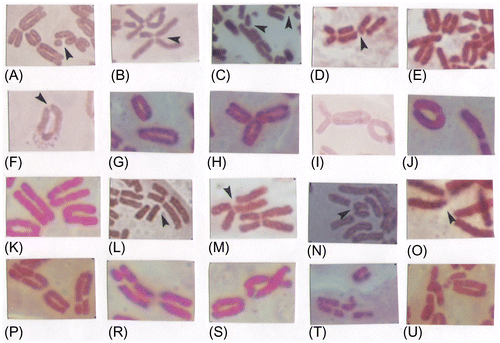 Figure 4. Chromatid and chromosome damage: (A, B) SBCt; (C) DBCt; (D) IctB; (E) MBCt; (F) CRCt; (G) ARCt; (H) TCs; (I) DCs; (J) RCs; (K) BCm; (L) GCe; (M) SBCe; (N) DBCe; (O) MBCe; (P) BCm+GCs; (R) BCm+SBCt+GCt; (S) BCm+ARCs+GCt; (T) BCm+IctB+BCt; (U) BCm+GCt+MBCt.