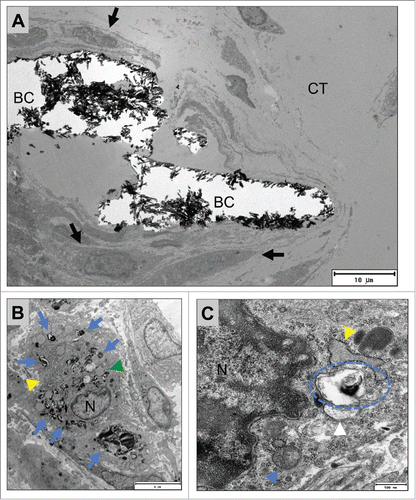 Figure 6. shows TEM images of the mononuclear cells involved in the tissue reactions to the BoneCeramic 400–700 µm (BC) bone substitute on day 15 after implantation. (A) Shows an overview of the implantation bed of BoneCeramic 400–700 µm granules (BC) within the subcutaneous connective tissue (CT) of the CD-1 mouse. At the surfaces of the granules, primarily mononuclear cells (black arrows) were detectable (690x magnification, scale bar = 10 µm). (B) Shows a material-related mononuclear cell that has vacuoles containing phagocytosed bone substitute material fragments (blue arrows). These vacuoles were regularly found within the cytoplasm of the cell in the direct vicinity of cisterns of the rough endoplasmic reticulum (yellow arrow head) as well as vacuoles with electron-dense contents (green arrow head) (N = nucleus) (1900x magnification, scale bar = 6 µm). (C) Shows the cytoplasm of the material-adherent phagocytosing mononuclear cell at a higher magnification. Vacuoles containing phagocytosed material fragments (blue dashed line) were regularly observed within the direct vicinity of cisterns of the rough endoplasmic reticulum (yellow arrow head) as well as other cell organelles that seemed to be involved in the process of active phagocytosis, such as mitochondria (blue arrow head) (N= nucleus). Interestingly, a vesicle (white arrow head) seemed to fuse with the vesicle containing the material fragment (13000x magnification, scale bar = 500 nm).