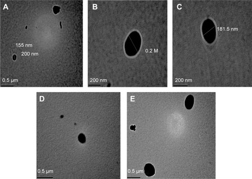 Figure 1 Photographs of aspirin-containing nanoemulsions of the present study by transmission electron microscopy.Notes: (A) Shows the size of one of the obtained nanoparticles which equals 155nm. (B) Shows an obtained nanoparticle with sphere shape and 200 nm diameter. (C) Shows a nanoparticle which is 181.5 nm. (D and E) Shows dispersed aspirin nanoparticles with a sphere shape.