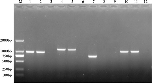 Figure 1. Identification of R. anatipestifer CH-1ΔermF mutant by PCR amplification. Samples were electrophoresed on a 1% agarose (w/v) gel. Wild-type R. anatipestifer CH-1 (lanes 1 and 7), CH-1ΔermF (lanes 2, 5, 8 and 11), plasmid pYES1 new (lane 4), plasmid pYA4278-RLS (lane 10) and distilled water (lanes 3, 6, 9 and 12) were used as template in PCR amplifications using the following sets of primers. Lanes 1–3: 16S rRNA F and 16S rRNA R, which amplify a 906-bp fragment from R. anatipestifer 16S rRNA. Lanes 4–6: Spc F and Spc R, which amplify a 1172-bp fragment from the SpecR cassette. Lanes 7–9: Erm F and Erm R, which amplify a 777-bp fragment of ermF, indicating the ermF gene was entire deleted. Lanes 10–12: IdentEF and IdentER, which amplify a 1036-bp fragment from the SpecR cassette, indicating it was inserted in the correct position in R. anatipestifer CH-1 genome. M: DNA Marker 2000.