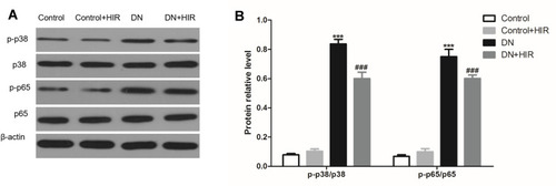 Figure 8 Effect of HIR on p38/NF-κB pathway in renal tissues. (A, B) Representative protein bands of p38, p-p38, p65, and p-p65 (A), and statistical comparison of gray values (B). Seven rats per group. ***Indicates P < 0.001 vs control group, and ###indicates P < 0.001 vs DN group.