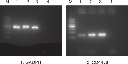 Figure 7 The result of RT-PCR analysis after transfection with PEG-PEI/siRNA.Notes: M: marker. From the bottom: 100 bp, 200 bp, 300 bp, 400 bp, 500 bp, 700 bp, 1000 bp. Lane 1: siRNA-CD44v6/PEG-PEI complexes group. Lane 2: negative control siRNA/PEG-PEI complexes group. Lane 3: no treatment group. Lane 4: negative control group without RNA template. GADPH was used as a control.Abbreviations: PEG-PEI, polyethylene glycol-polyethyleneimine; N/P, charge ratio between amino groups of PEG-PEI and phosphate groups of siRNA; GADPH, glyceraldehyde 3-phosphate dehydrogenase.