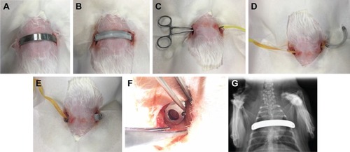 Figure 2 Illustration of the surgical procedure.Notes: (A) Plain stainless steel bar before implantation. (B) Biodegradable lidocaine/ketorolac/poly(D,L)-lactide-co-glycolide (PLGA) nanofibrous membrane-coated stainless steel bar before implantation. (C) Pean clamp was used to create a substernal tunnel. (D) Polyester tape was brought into the substernal tunnel by the Pean clamp. The end of the tape was tied to the end hole in the metal bar. (E) The metal bar was guided into the substernal tunnel by the traction of the polyester tape, with the convexity facing the dorsal side of the animal. (F) The end hole of the metal bar after the bar was rotated 180° so that the convexity faced the sternum. (G) X-ray image of the animal after the operation.