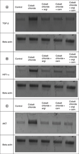 Figure 5. (A–C) Representative immunoblots (Western blot analysis) of renal TGF-β, HIF1-α, and AKT in control and different treated groups.