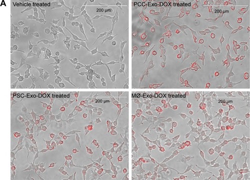 Figure 5 Comparison of cellular uptake of different Exo-DOX formulations.Notes: PCCs were treated with vehicle, PCC-Exo-DOX, PSC-Exo-DOX, or MØ-Exo-DOX (with free DOX equivalent 85.32 nM). (A) A representative image from EVOS fluorescence microscopy, depicting the uptake of Exo-DOX formulations. (B) Mean fluorescence intensity count at 528 nm quantified by fluorescence reader.Abbreviations: DOX, doxorubicin; MØ, macrophage; PCCs, pancreatic cancer cells; PSC, pancreatic stellate cell.