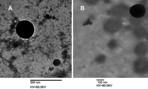 Figure 1 Transmission electron microscopy image of pDNA-loaded chitosan-sodium deoxycholate nanoparticles (A) F10 and (B) F15.