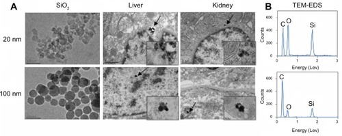Figure 3 TEM images of silica nanoparticles before administration and liver and kidney tissues collected at 48 hours after the oral administration of 20 nm or 100 nm sized nanoparticles.Notes: (A) Higher magnification of the tissues where nanoparticles are present, indicated by arrow. (B) TEM-EDS images show the presence of Si in the particulate forms in the tissues.Abbreviations: EDS, energy dispersive spectroscopy; Si, silicon; SiO2, silica; TEM, transmission electron microscopy.
