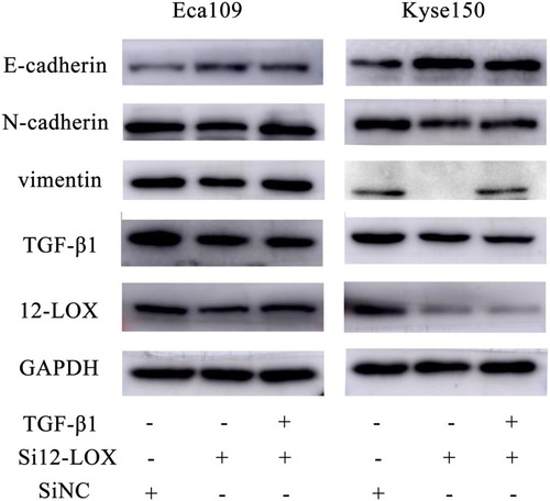 Figure 5 Regulation of si12-LOX and 12(S)-HETE in EMT-related proteins in ESCC cells. The left panel showed that the expression of 12-LOX, TGF-β1, vimentin and N-cadherin in Eca109 cells were reduced after treated by si12-LOX and that of E-cadherin was increased, and the changes were relieved after addition of TGF-β1 to some extent; right panel indicates similar results observed in Kyse150 cells.Abbreviations: ESCC, esophageal squamous cell carcinoma; EMT, epithelial-mesenchymal transition.