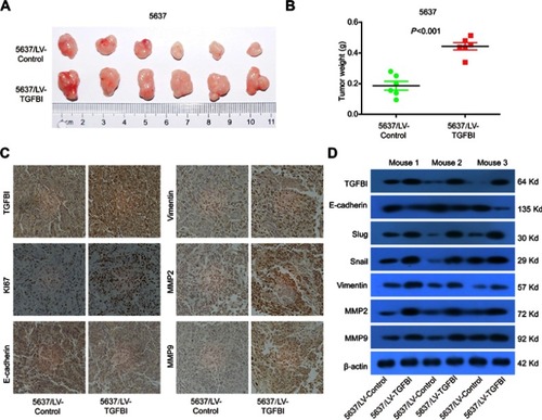 Figure 5 TGFBI promoted the tumorigenicity of BCa cells in vivo. (A) Representative images of tumors in5637/LV-control and 5637/LV-TGFBI groups in nude mice. (B) Weights of the xenograft tumors are presented (n=6). (C) Representative images of TGFBI, KI67, E-cadherin, Vimentin, MMP2, and MMP9 in tumors formed by the indicated cells. (D) Tumors were lysed, and the total levels of TGFBI, EMT markers, and GAPDH were detected by Western blotting.