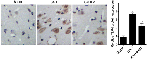 Figure 7. TLR4 protein level was the lowest in the sham group and the highest in the SAH group (Scale bar: 10 um).