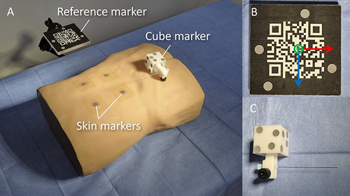 Figure 3 Retroreflective markers for patient and tool tracking. (A) skin markers on the patient mock-up, (B) a reference marker, and (C) a cube marker for needle tracking.
