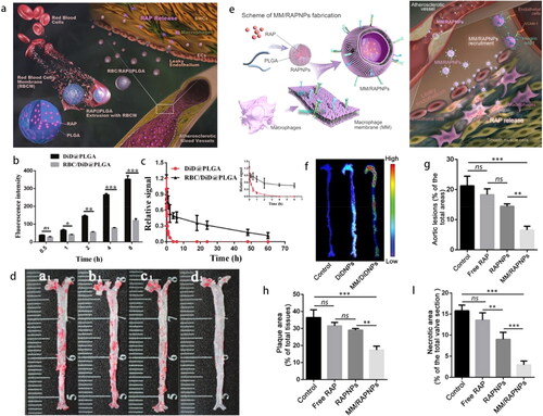 Figure 7. (a) Schematic of RBC/RAP@PLGA for AS treatment. (b) Reduced cellular uptake of NPs in macrophages and (c) prolonged body circulation. (d) The atherosclerotic lesions of aortas from each group (a1, Control; b1, Free drug; c1, RAP@PLGA; d1, RBC/RAP@PLGA) (Wang et al., Citation2019b). Copyright 2019 Wiley-VCH. (e) Schematic of MM/RAPNP for AS treatment. (f) Targeting atherosclerotic plaques. Quantitative analysis of (g) the lesion area, (h) lipid deposition area and (i) necrotic cores of plaque lesions in the cross-sections of the aortic root (Wang et al., Citation2021). Copyright 2021 IVY Publisher.