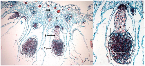 Figure 10. Sporophytes of Marchantia. (A) Sporophyte (hanging downward) with foot (F) embedded in the archegoniophore (ARP). The seta (S) supports the capsule (C) containing spores. (A) Enlargement of the capsule showing thread-like elaters (arrows). Images were obtained from slides and used with permission from Carolina Biological Supply, Whitsett, North Carolina, Copyright Carolina Biological Supply.