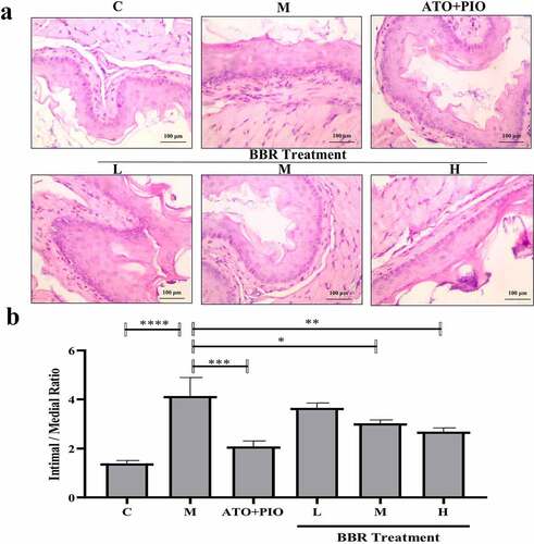 Figure 3. BBR inhibited neointima formation in ApoE−/− mice carotid arteries. (a) H&E staining representative image of carotid artery (magnification 200); (b) carotid artery intima/media thickness ratio; the findings were presented as mean ± SD; * P < 0.05, ** P < 0.01, *** P < 0.001, **** P < 0.0001