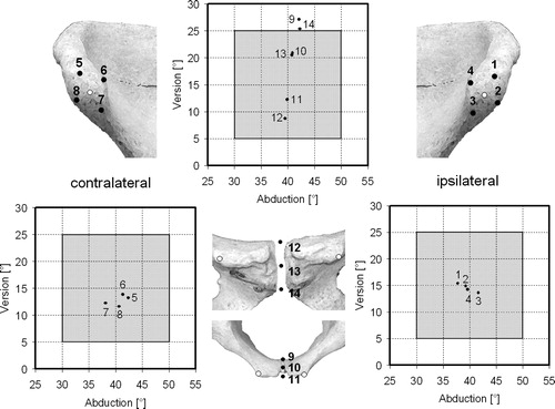 Figure 6. The influence of malregistration of the pelvic reference coordinate system is shown. The white spots represent the real bony landmarks (the anterior superior iliac spines and the pubic tubercles) of the APP. The resulting mean angle of a maldefined point is shown in the scatter diagrams, e.g., defining the pubis point too posteriorly (point 9) would lead to a more anteverted cup.