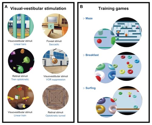 Figure 2 Components of the BRU-training protocol. Each training session lasted 30 minutes and consisted of a combination of visual-vestibular rehabilitation (A) and postural training virtual reality exercises (B). The rehabilitation exercises (A) included saccadic and optokinetic stimulation. Postural training exercises (B) consisted of three different games (maze, breakfast and surfing) with increasing levels of complexity (maximum of 15 levels).Citation33