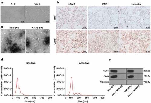 Figure 1. Identification of CAFs and CAFs-EVs. CAFs and EVs were extracted from NSCLC tissue. A: Microscope was used to observe the morphology of CAFs; B: Immunocytochemistry was adopted to detect the expressions of α-SMA (smooth muscle alpha-actin), vimentin and FAP (fibroblast activation protein) in CAFs; C: Electron microscope was used to observe the morphology of CAFs-EVs; D: Nanoparticle tracking analysis (NTA) was performed to analyze the size and concentration of EVs; E: Western blot was used to test the levels of EVs-specific markers CD63, CD81, and Calnexin. The cell experiment in panels C-D was repeated 3 times independently.