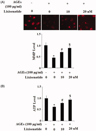 Figure 1. Lixisenatide ameliorates advanced glycation end products (AGEs)-induced mitochondrial dysfunction. (A) Mitochondrial membrane potential was measured by TMRM; (B) Intracellular ATP levels were determined by a luciferase assay (*, #, $, p < .01).