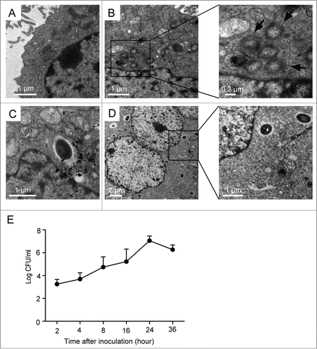 Figure 1. Intracellular survival and replication of B. pseudomallei in A549 cells. (A) Representative TEM image of control A549 cells. (B–D) A549 cells were infected with B. pseudomallei at an MOI of 10 for 2, 12, and 24 h, respectively. The scale bars are indicated. (B) Representative TEM images of intracellular autophagosomes within A549 cells at 2 h p.i. Arrows indicate autophagosomes. (C) TEM image of intracellular B. pseudomallei within A549 cells at 12h. (D) TEM images of intracellular B. pseudomallei within A549 cells at 24 h p.i. The left panel shows multinucleated giant cells. Boxed areas are shown as magnified images on the right panel. (E) Multiplication of B. pseudomallei in A549 cells. A549 cells infected with B. pseudomallei (MOI = 10:1) for 2, 4, 8, 16, 24, and 36 h were lysed, and intracellular bacteria were quantified after inoculation. The recovered viable B. pseudomallei were determined as CFU on a LB plate. Results shown are representative of 3 independent experiments.