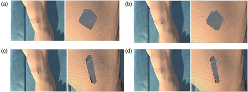 Figure 5. Simulation of the removal of particles that make up the skin on a human leg. In the traditional PBD method, the removed particles and the area of the mesh formed by the particles disappear without leaving any debris (a) and (c). When removing particles in the same region, the proposed method creates a new particle at the predicted position based on Tresca's yield criterion and remeshes it with nearby particles (b) and (d). (a) The result of removing the tissue on the leg in a rectangular shape using the traditional PBD method, zoomed out (left) and zoomed in (right). (b) The result of removing the tissue on the leg in a rectangular shape using the proposed method, zoomed out (left) and zoomed in (right). (c) The result of removing the tissue on the leg vertically using the traditional PBD method, zoomed out (left) and zoomed in (right). (d) The result of removing the tissue on the leg vertically using the proposed method, zoomed out (left) and zoomed in (right).