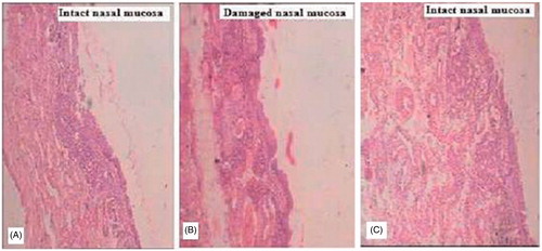 Figure 1. Microscopic images illustrate the histopathological condition of nasal mucosa after 2 h exposure of (A, negative control) PBS pH 6.4; (B, positive control) IPA; (C) drug-loaded nanoemulsion.