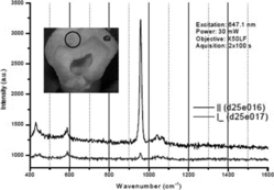 Figure 1 Raman spectroscopy of a sound and carious enamel. Courtesy of Ionita (Citation19).