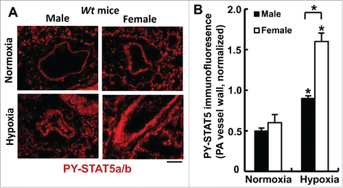 FIGURE 4. Sex-biased activation of PY-STAT5a/b in pulmonary arterial walls in wild-type mice after 7 weeks of chronic hypoxia (expt. as in Fig. 6). At the conclusion of the experiment in Fig. 6, quantitative immunofluorescence was used to evaluate levels of PY-STAT5a/b in the arterial walls of pulmonary arterial segments in sections of lungs using methods previously described (83). *P <0.05 in comparisons between hypoxia and normoxia groups of the 2 sexes; and also in the male vs female hypoxia comparison; scale bar = 50 µm.