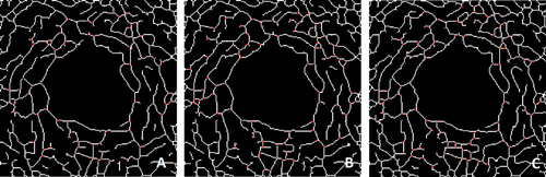 Figure 3 Detection of branching points (red dots) on the automatically traced and skeletonized capillary network (white lines). Network traced in (Figure 3A-C) coincides with that illustrated in (Figure 2A-C), respectively, and results from progressively lowering image intensity grayscale thresholds from left to right.