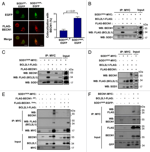Figure 7. Mutant SOD1 interacts with the BECN1-BCL2L1 complex. (A) Colocalization analysis between FLAG- BECN1 and wild-type or mutant SOD1G85R-EGFP in NSC34 cells. NSC34 cells were transiently cotransfected with expression vectors for human SOD1WT or SOD1G85R-EGFP fusion protein and FLAG- BECN1. After 24 h, SOD1 distribution was visualized by confocal fluorescent microscopy (green) and FLAG- BECN1 detected by indirect immunofluorescence (red). Merge images are provided. Right panel: SOD1G85R-EGFP and FLAG-BECN1 colocalization index was calculated using the Manders coefficient. Mean and standard error is presented. P value was calculated with the Student t test. (B) SOD1G93A-MYC, (C) SOD1G85R-MYC or (D) SOD1WT-MYC or SOD1G93A-MYC (control) were expressed in 293T cells together with BCL2L1 and BECN1-FLAG tagged versions. Immunoprecipitation (IP) assays were performed using anti-MYC antibody-agarose complexes followed by western blot analysis to assess the interaction with BCL2L1 and BECN1. Total protein extracts are shown as control. Results are representative of 3 independent experiments. (E) SOD1G93A-MYC IP was performed in NSC34 cells cotransfected with mutant FLAG-BECN1WT or BECN1delta, and FLAG-BCL2L1 followed by western blot analysis. (F) IP was performed with anti-MYC antibody-agarose complexes in NSC34 cells cotransfected with BECN1-MYC, FLAG-BCL2L1 and mutant SOD1 (both EGFP-tagged). This figure is representative of 3 independent experiments.