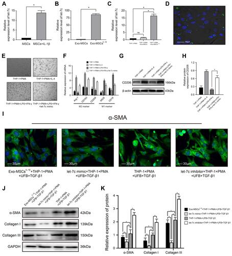 Figure 3 miRNA let-7c is enriched in exosomes isolated from IL-1β-induced MSCs and inhibits myofibroblast formation by promoting macrophage M2 polarization. (A–C) qRT-PCR analysis of let-7c expression in (A) MSCs incubated with or without IL-1β for XX h; (B) Exo-MSCs or Exo-MSCsIL−1β; and (C) THP-1 cells treated with saline + PMA, Exo-MSCs + PMA, or Exo-MSCsIL−1β + PMA for 48 h. (D) Epifluorescence images of uptake of PKH-67-labeled exosomes (green) taken up by PMA-treated THP-1 cells. Nuclei were stained with Hoechst 33342 (blue). (E) Light microscopy images showing THP-1 cells incubated with the indicated factors. (F) qRT-PCR analysis of mRNA expression levels of the indicated macrophage markers after incubation of THP-1 cells with the indicated factors. (G and H) Western blot analysis (G) and quantification of band densities (H) of CD206 after incubation of THP-1 cells with the indicated factors. (I) Immunofluorescence images of α-SMA expression in UFBs after incubation with the indicated cells and factors. (J and K) Western blot analysis (J) and quantification of band densities (K) of α-SMA, collagen I, and collagen III in UFBs treated as described for (I). Data in (A–C, F, H, and K) are presented as the mean ± SD of at least three independent experiments and were analyzed with Student’s t-test or one-way ANOVA (*P < 0.05).