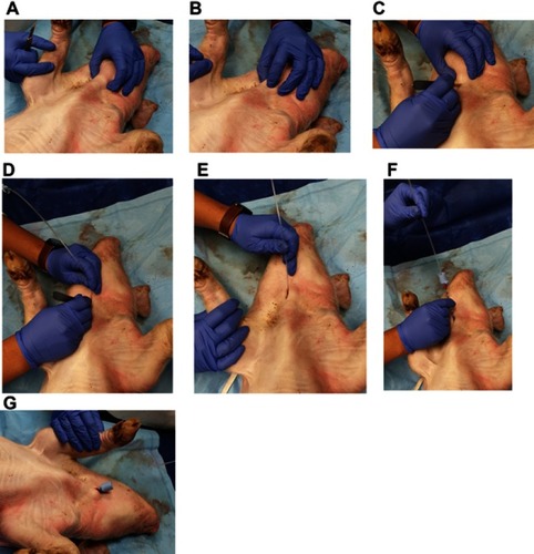 Figure 3 The CTT procedure performed on the pig model (A-G).