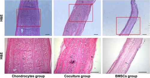 Figure 4 Histology of cell-scaffold constructs after 12 weeks in vivo in the different groups.Notes: Tissue sections were stained with H&E. Arrows show nondegraded GT/PCL nanofibrous membranes. Scale bars: 200 μm.Abbreviations: H&E, hematoxylin and eosin; BMSC, bone marrow stromal cell; GT/PCL, gelatin/polycaprolactone.