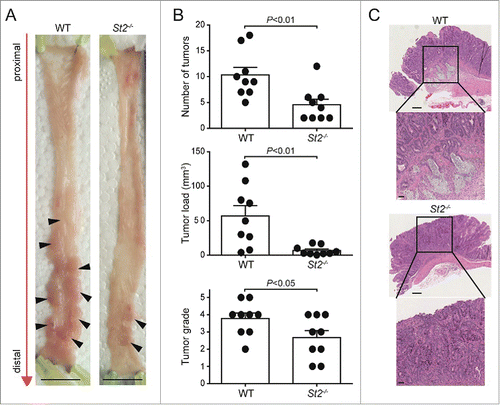Figure 2. Genetic disruption of the IL-33/ST2 axis protects mice from AOM/DSS-induced CRC. (A) Macroscopic pictures of colonic tumors in representative WT and St2−/− mice. Black arrowheads indicate single tumors. (B) Reduction in number of tumors, tumor load and tumor grade in St2−/− compared with WT mice. (C) Representative hematoxylin and eosin (H&E) sections displaying the most advanced tumor grades in WT and St2−/− groups. Scale bars: overview: 200 µm; inlay 50 µm. Data represent means ± SEM; n = 9 samples per group. Statistical analyses were performed using Student t test (tumor number and severity) or Mann–Whitney test (tumor load).