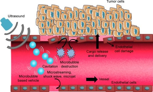 Figure 2 Schematic of enhanced delivery of UMMD.