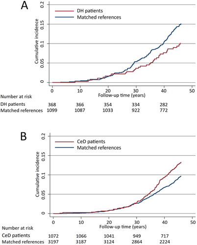 Figure 2. Kaplan-Meier failure curves estimating the cumulative incidence of all cerebrovascular outcomes studied in dermatitis herpetiformis (DH) patients (A, diabetes mellitus adjusted hazard ratio 0.68; 95% CI 0.47–0.99) and coeliac disease (CeD) patients (B, diabetes mellitus adjusted hazard ratio 1.33; 95% CI 1.07–1.66).