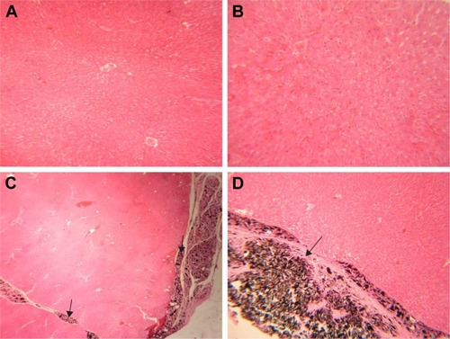 Figure 3 Histopathological effects of GONs on the liver of rats after 21 days. Representative photomicrograph of (A) Control rats (H&E, ×100), (B) Rats receiving 50 mg/kg of GONs (H&E, ×100), (C) rats receiving 150 mg/kg of GONs (H&E, ×100), and (D) Rats receiving 500 mg/kg of GONs (H&E, ×100).Note: Black arrows indicate the accumulation of GONs.Abbreviations: GONs, graphene oxide nanoplatelets; H&E, hematoxylin and eosin.